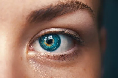 Optivision #1