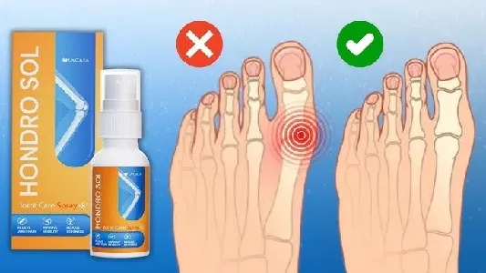 Hondro Sol Valgus #1