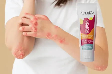 Nutridia (psorias) #1