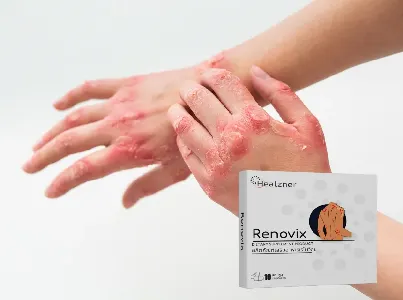 Renovix #1