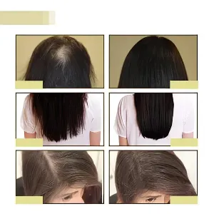 Eelhoe Hair Oil #3